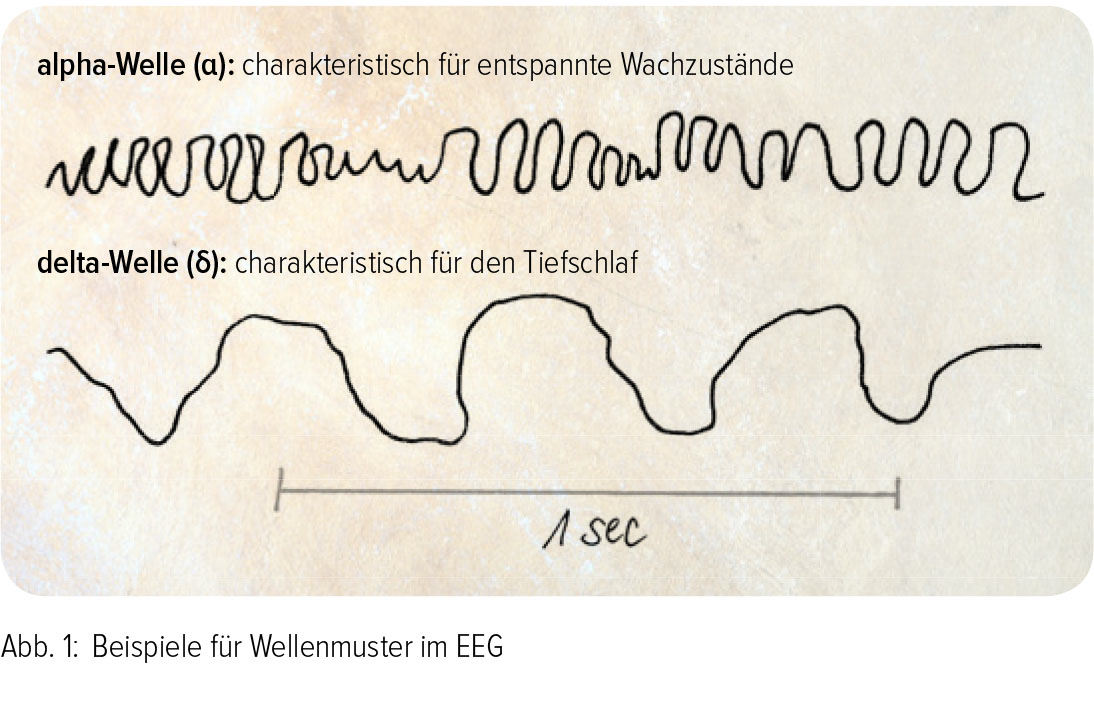 Abb. 1: Beispiele für Wellenmuster im EEG