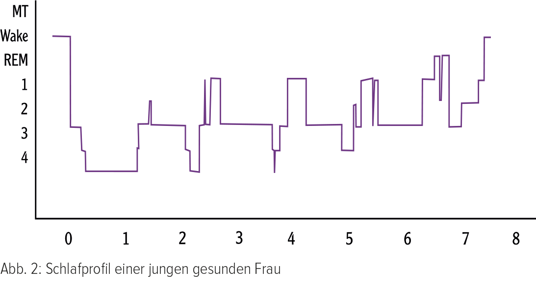 Abb. 2: Schlafprofil einer jungen gesunden Frau